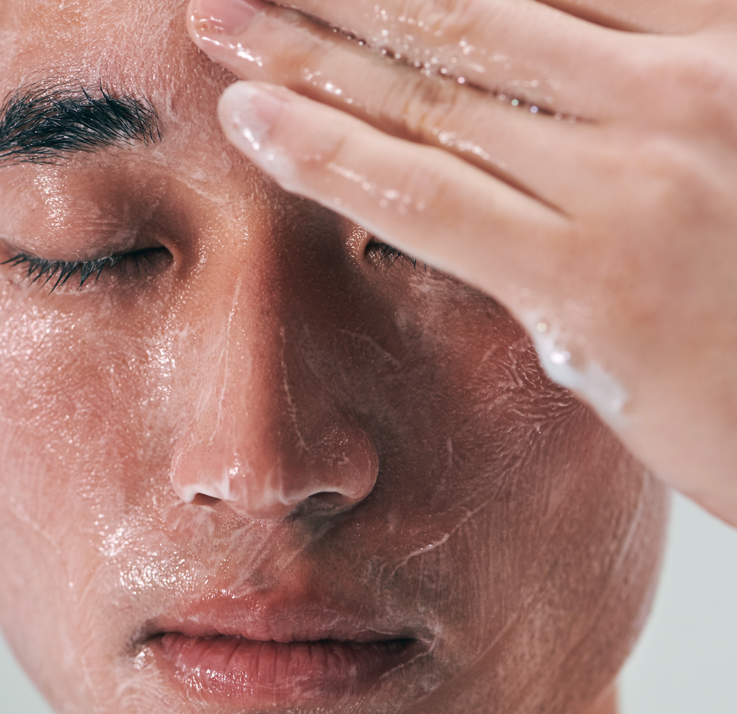 Can Stress Cause Acne? Anxiety & Skin Care