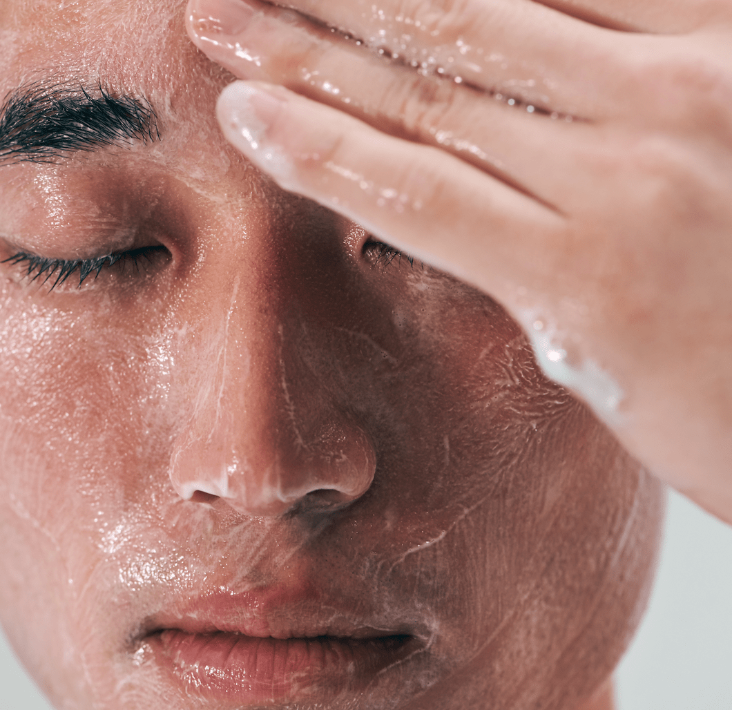 Can Stress Cause Acne? Anxiety & Skin Care - Jander